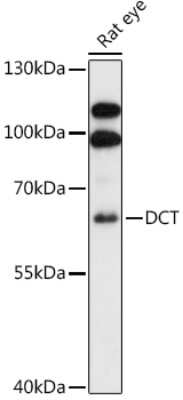 Western Blot: TRP2 AntibodyAzide and BSA Free [NBP2-93161]